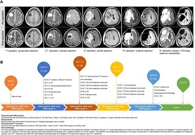 Frontiers Case Report Temozolomide Induced Hypermutation An